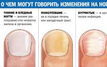 Как восстановить здоровый вид ногтей